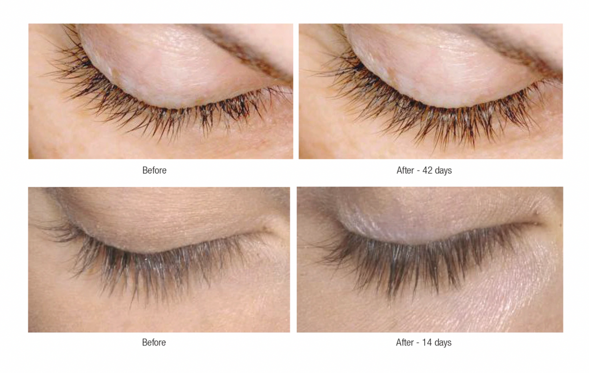 Lash Therapy™- Eyelash + Eyebrow Conditioning Treatment